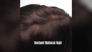 Medium Brown French Lace Hair System 9x11
